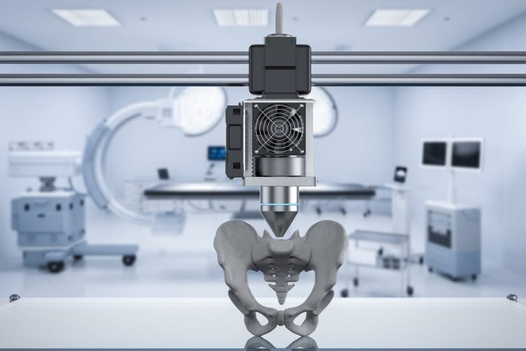 3D prototype of prosthetic hip bone