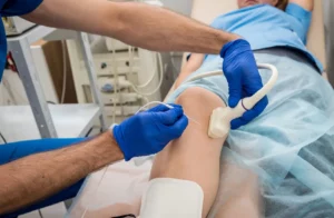 What is Radio Frequency Ablation